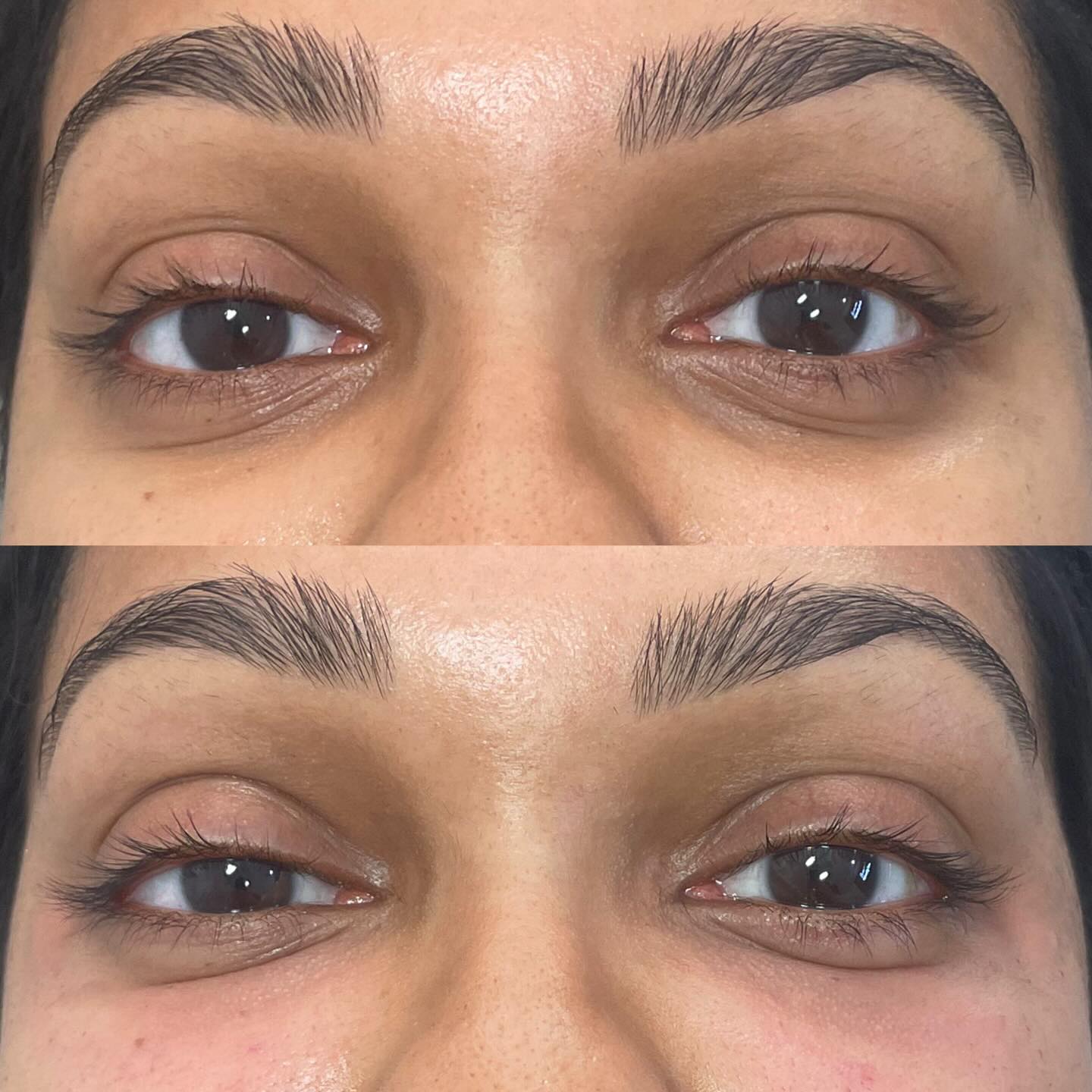 Georgetown tx eye treatment