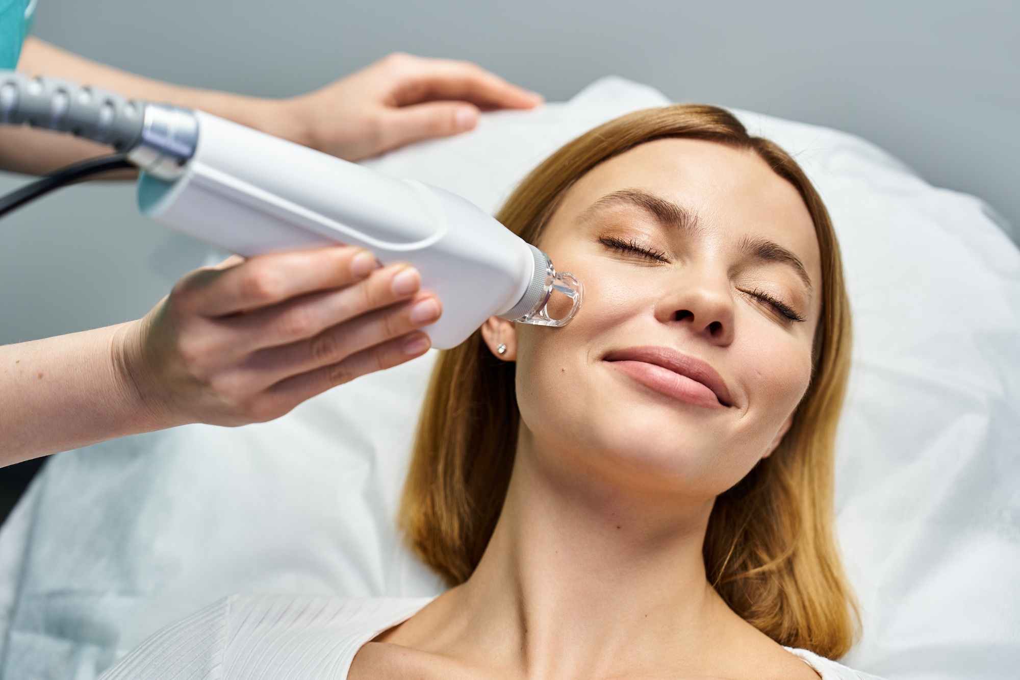 microneedling
