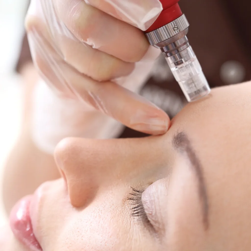 Microneedling Georgetown, TX