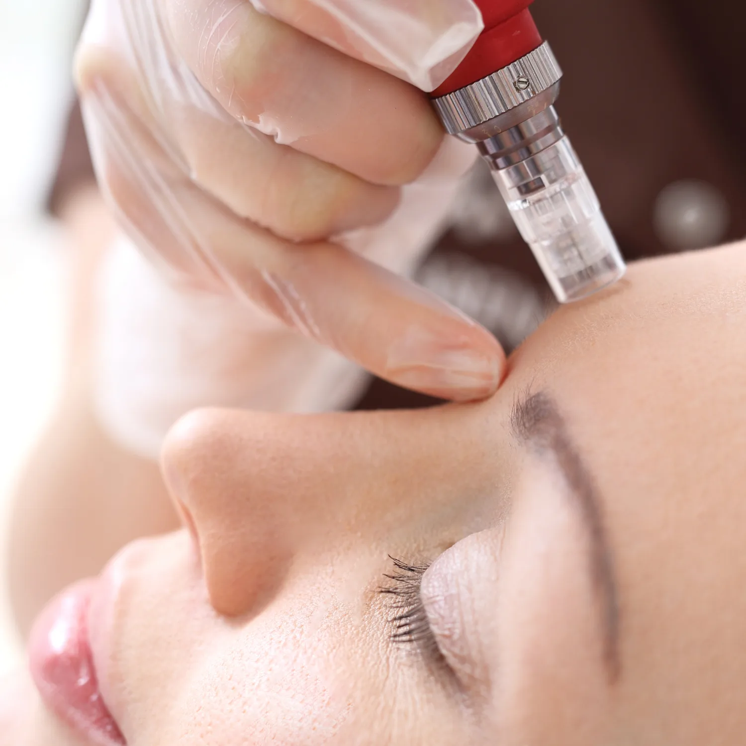 Microneedling Georgetown, TX